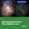 Rogaine 5% Minoxidil 男士生髮劑