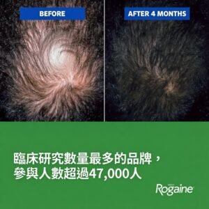 Rogaine 5% Minoxidil 男士生髮劑